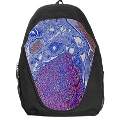 Histology Inc Histo Logistics Incorporated Human Liver Rhodanine Stain Copper Backpack Bag by Mariart