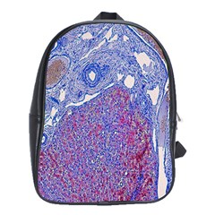 Histology Inc Histo Logistics Incorporated Human Liver Rhodanine Stain Copper School Bag (xl)