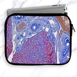 Histology Inc Histo Logistics Incorporated Human Liver Rhodanine Stain Copper Apple iPad 2/3/4 Zipper Cases Front