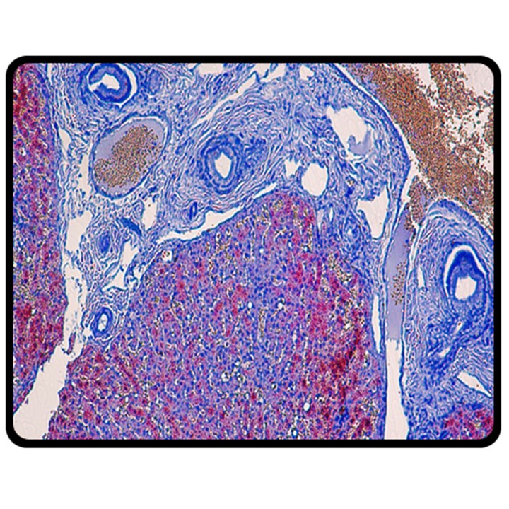 Histology Inc Histo Logistics Incorporated Human Liver Rhodanine Stain Copper Double Sided Fleece Blanket (Medium) 