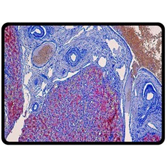 Histology Inc Histo Logistics Incorporated Human Liver Rhodanine Stain Copper Double Sided Fleece Blanket (large)  by Mariart