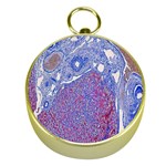 Histology Inc Histo Logistics Incorporated Human Liver Rhodanine Stain Copper Gold Compasses Front