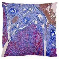 Histology Inc Histo Logistics Incorporated Human Liver Rhodanine Stain Copper Standard Flano Cushion Case (two Sides) by Mariart