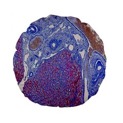 Histology Inc Histo Logistics Incorporated Human Liver Rhodanine Stain Copper Standard 15  Premium Flano Round Cushions by Mariart