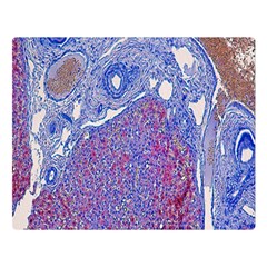 Histology Inc Histo Logistics Incorporated Human Liver Rhodanine Stain Copper Double Sided Flano Blanket (large)  by Mariart