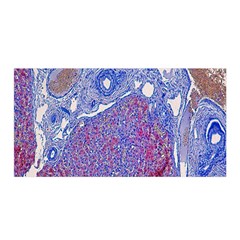 Histology Inc Histo Logistics Incorporated Human Liver Rhodanine Stain Copper Satin Wrap by Mariart