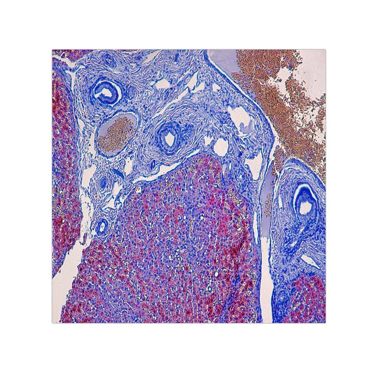 Histology Inc Histo Logistics Incorporated Human Liver Rhodanine Stain Copper Small Satin Scarf (Square)