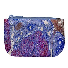 Histology Inc Histo Logistics Incorporated Human Liver Rhodanine Stain Copper Large Coin Purse by Mariart