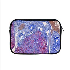 Histology Inc Histo Logistics Incorporated Human Liver Rhodanine Stain Copper Apple Macbook Pro 15  Zipper Case by Mariart