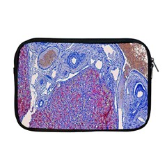 Histology Inc Histo Logistics Incorporated Human Liver Rhodanine Stain Copper Apple Macbook Pro 17  Zipper Case by Mariart