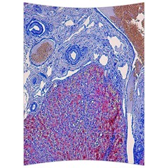 Histology Inc Histo Logistics Incorporated Human Liver Rhodanine Stain Copper Back Support Cushion by Mariart