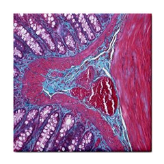 Natural Stone Red Blue Space Explore Medical Illustration Alternative Tile Coasters