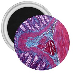 Natural Stone Red Blue Space Explore Medical Illustration Alternative 3  Magnets by Mariart