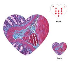 Natural Stone Red Blue Space Explore Medical Illustration Alternative Playing Cards (heart)  by Mariart