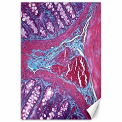 Natural Stone Red Blue Space Explore Medical Illustration Alternative Canvas 12  X 18  