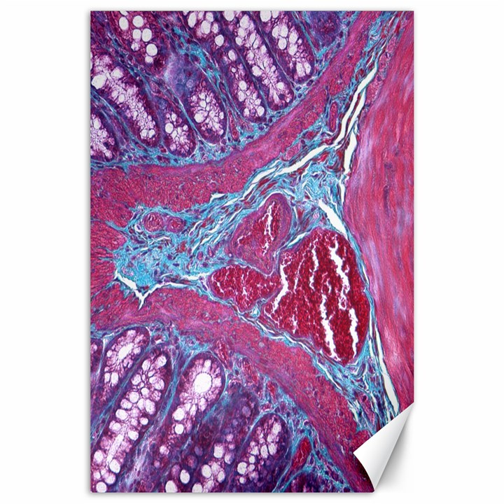 Natural Stone Red Blue Space Explore Medical Illustration Alternative Canvas 24  x 36 