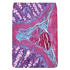 Natural Stone Red Blue Space Explore Medical Illustration Alternative Flap Covers (l)  by Mariart