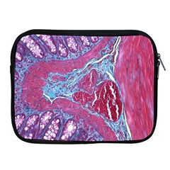 Natural Stone Red Blue Space Explore Medical Illustration Alternative Apple Ipad 2/3/4 Zipper Cases by Mariart