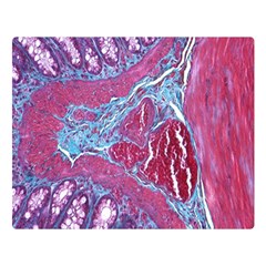 Natural Stone Red Blue Space Explore Medical Illustration Alternative Double Sided Flano Blanket (large)  by Mariart