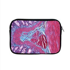 Natural Stone Red Blue Space Explore Medical Illustration Alternative Apple Macbook Pro 15  Zipper Case