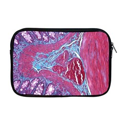 Natural Stone Red Blue Space Explore Medical Illustration Alternative Apple Macbook Pro 17  Zipper Case