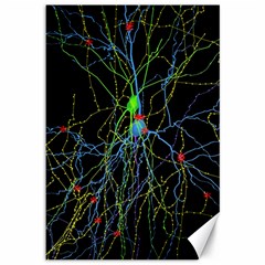 Synaptic Connections Between Pyramida Neurons And Gabaergic Interneurons Were Labeled Biotin During Canvas 12  X 18   by Mariart