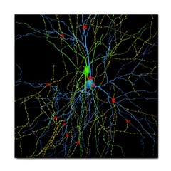 Synaptic Connections Between Pyramida Neurons And Gabaergic Interneurons Were Labeled Biotin During Face Towel by Mariart