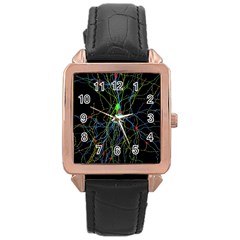 Synaptic Connections Between Pyramida Neurons And Gabaergic Interneurons Were Labeled Biotin During Rose Gold Leather Watch  by Mariart