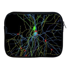 Synaptic Connections Between Pyramida Neurons And Gabaergic Interneurons Were Labeled Biotin During Apple Ipad 2/3/4 Zipper Cases by Mariart