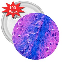 The Luxol Fast Blue Myelin Stain 3  Buttons (100 Pack) 