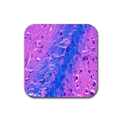 The Luxol Fast Blue Myelin Stain Rubber Coaster (square) 