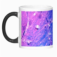 The Luxol Fast Blue Myelin Stain Morph Mugs by Mariart