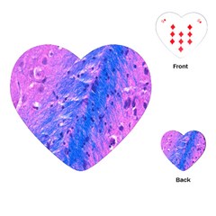 The Luxol Fast Blue Myelin Stain Playing Cards (heart) 