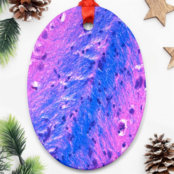 The Luxol Fast Blue Myelin Stain Oval Ornament (Two Sides)