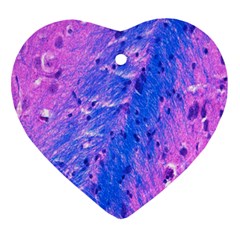 The Luxol Fast Blue Myelin Stain Heart Ornament (two Sides) by Mariart