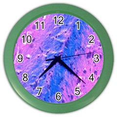 The Luxol Fast Blue Myelin Stain Color Wall Clocks by Mariart