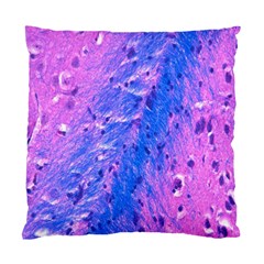 The Luxol Fast Blue Myelin Stain Standard Cushion Case (one Side) by Mariart