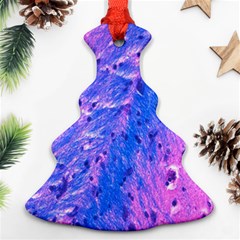 The Luxol Fast Blue Myelin Stain Ornament (christmas Tree) 