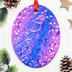 The Luxol Fast Blue Myelin Stain Ornament (oval Filigree) by Mariart