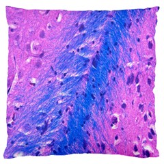 The Luxol Fast Blue Myelin Stain Standard Flano Cushion Case (two Sides) by Mariart