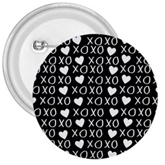 Xo Valentines Day Pattern 3  Buttons by Valentinaart