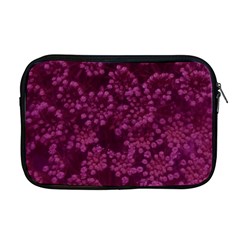 Dark Pink Queen Anne s Lace (up Close) Apple Macbook Pro 17  Zipper Case by okhismakingart