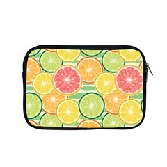 It Is Summer!! Apple MacBook Pro 15  Zipper Case