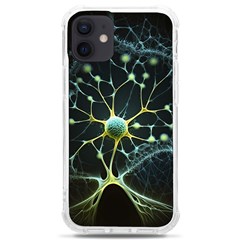 Neuron Network Iphone 12 Mini Tpu Uv Print Case	 by Ndabl3x