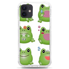 Kawaii-frog-rainy-season-japanese Iphone 12 Mini Tpu Uv Print Case	 by Grandong