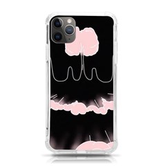 Garage Indie Arctic Monkeys Psychedelic Punk Rock Iphone 11 Pro Max 6 5 Inch Tpu Uv Print Case by Sarkoni