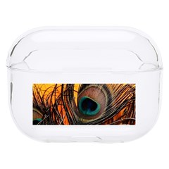 Forest Trees Snow Landscape Art Hard Pc Airpods Pro Case by Cemarart