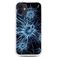 Neurons Brain Cells Structure Iphone 12/12 Pro Tpu Uv Print Case by anzea