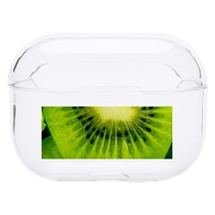 Kiwi Fruits, Close-up, Exotic Fruit Hard Pc Airpods Pro Case by kyorashop23